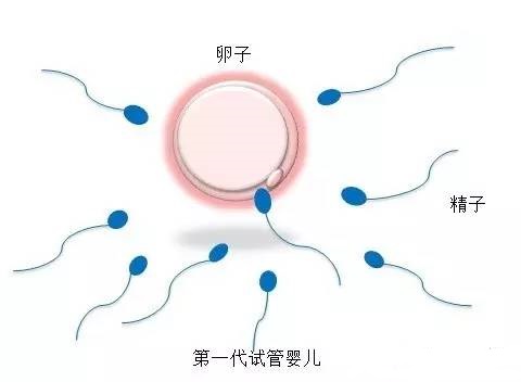 安孕冻胚移植专科